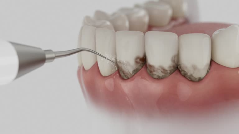 Trusted Emergency Dentist service in Upper Exeter, PA - Dentist Open Now